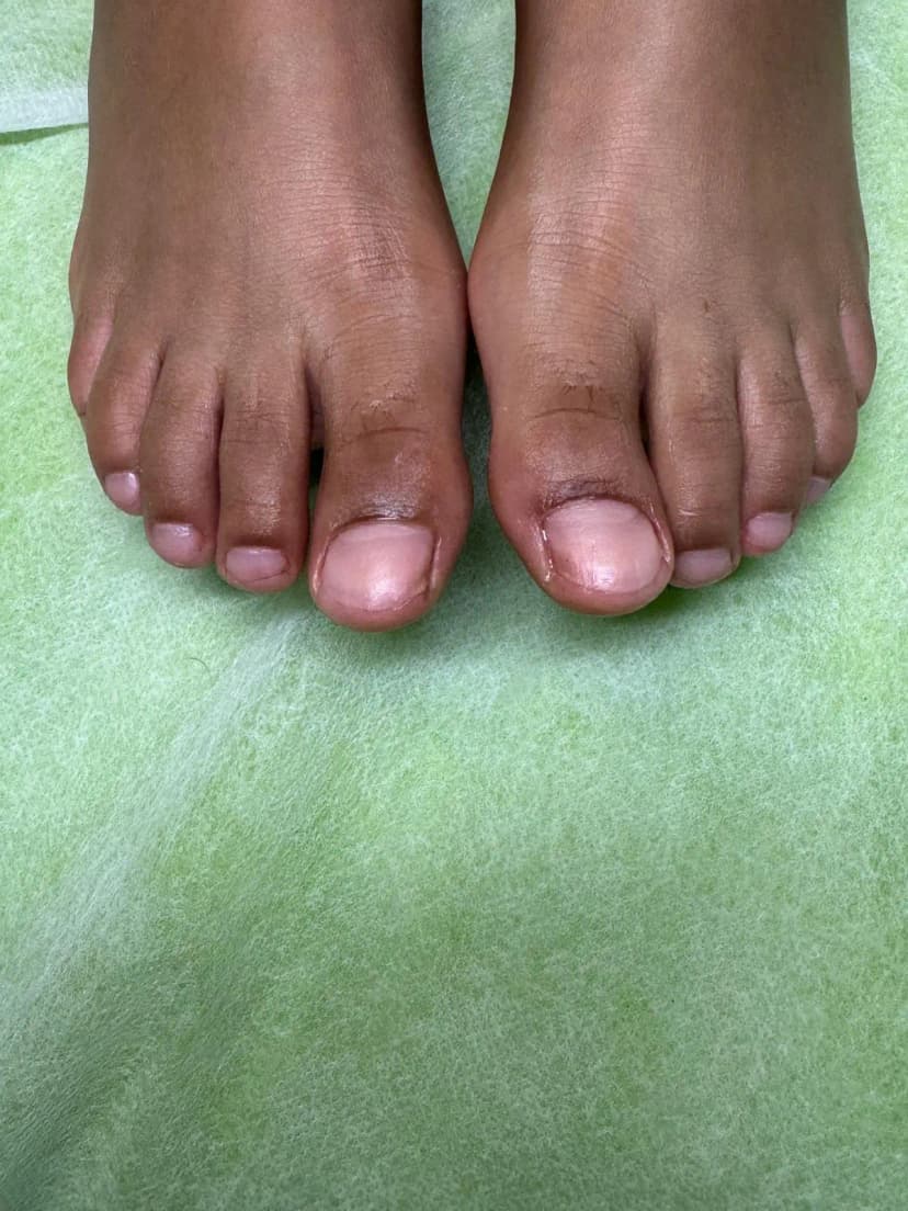 אחרי - חודרנית